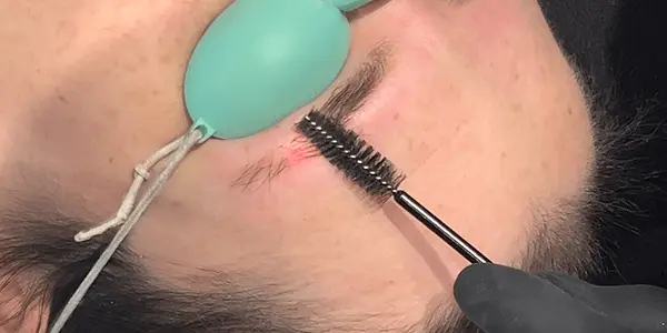 Formation privée détatouage